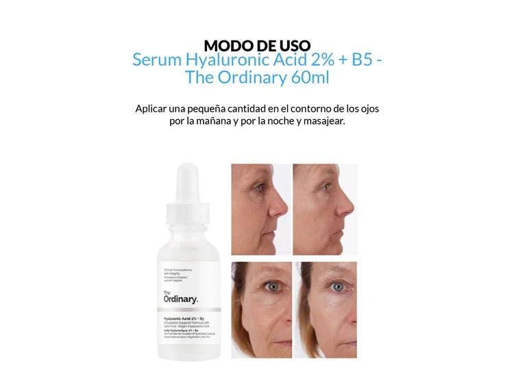 Serum facial acido hialuronico 2% + B5 - The Ordinary (60ml)